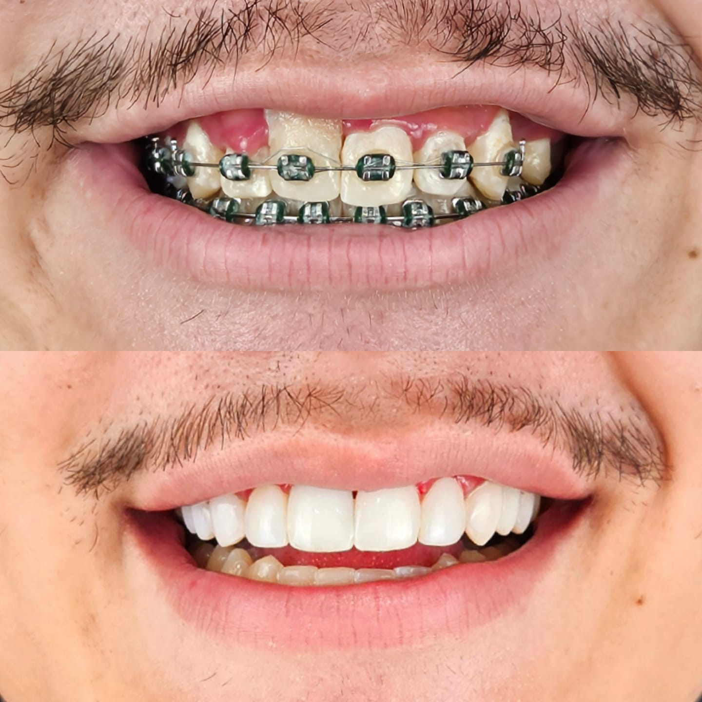 Registro de prótese e lentes enviado pela Carabelly.