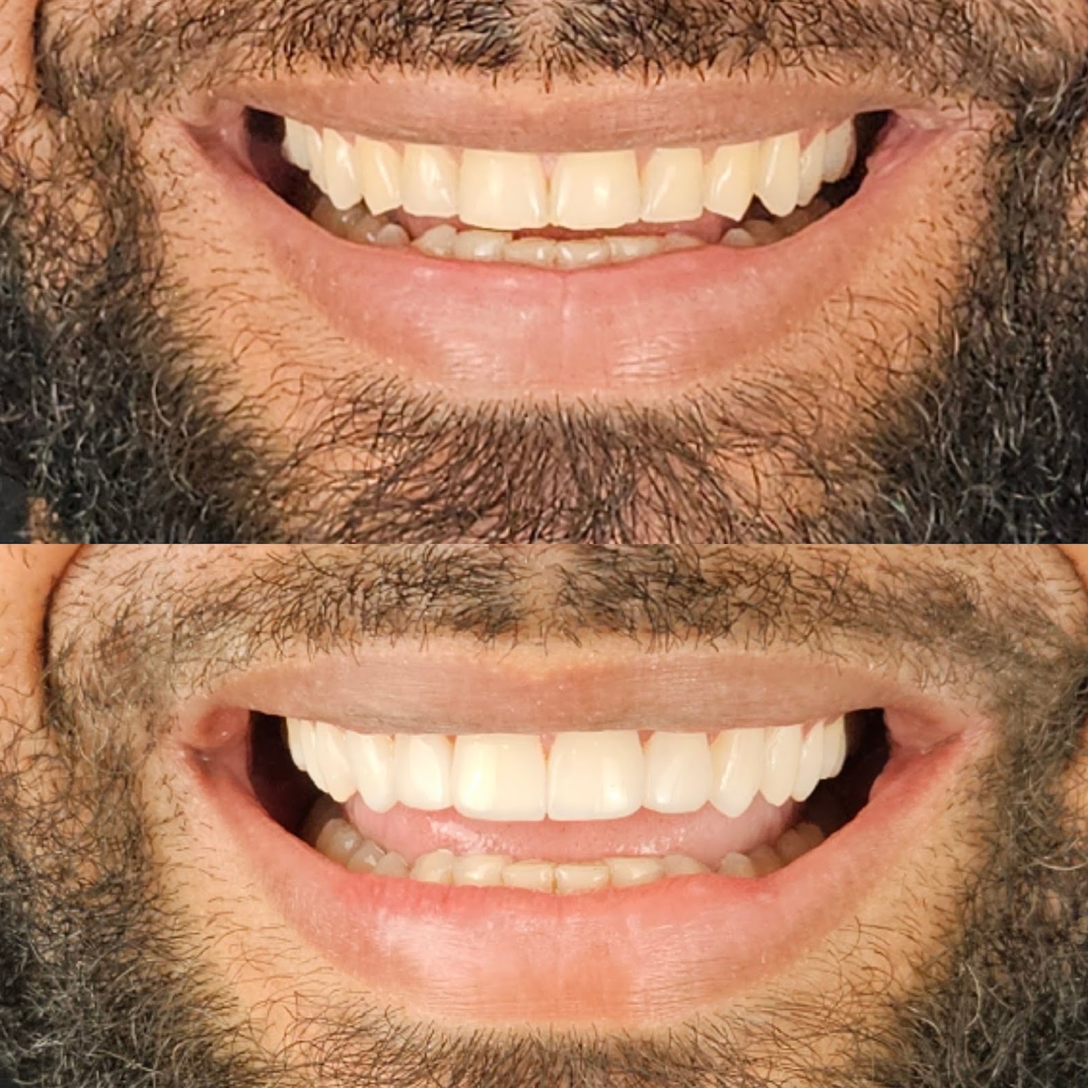Registro fotográfico de sorriso enviado pela Carabelly.
